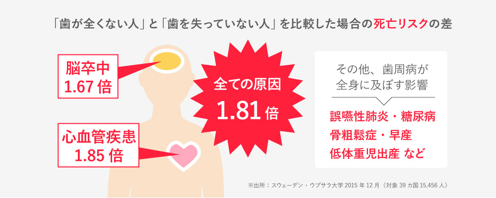 「歯が全く無い人」は、「歯を失っていない人」と比較した場合に、死亡リスクが1.81倍になるとの情報があります。（※スウェーデン・ウブラザ大学による調査より・2015年12月（対象39か国、15,456人）