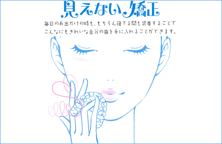 「見えない矯正」毎日のお出かけの時も、もちろん寝ている間も装着することで、こんなにもきれいな自分の歯を手に入れる事ができます。