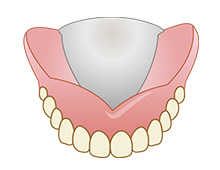 総入れ歯のイメージ画像