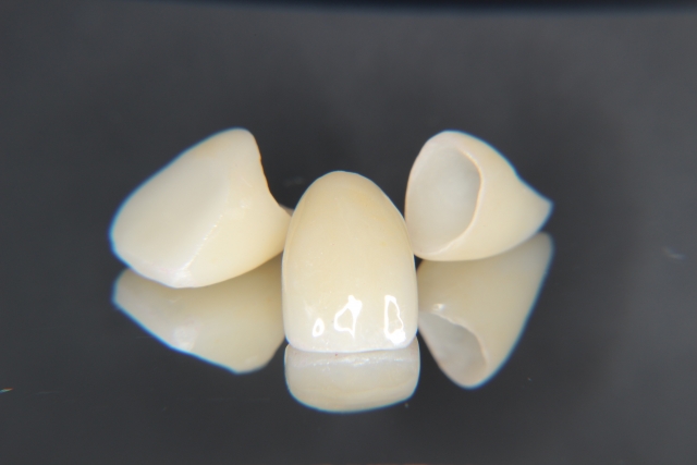 前歯部ジルコニアクラウン
